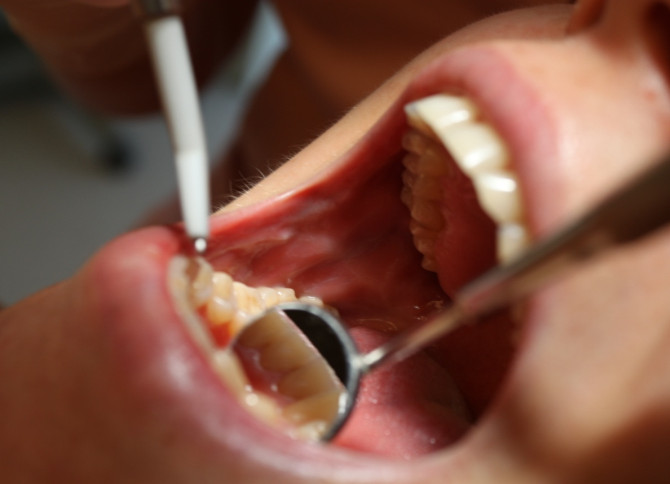 dentalcare-10_leczenie2